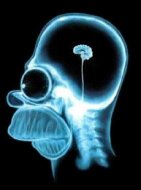 Radiografía de Homer Simpson con un cerebro del tamaño de un cacahuete